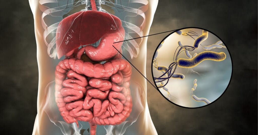 H. pylori bacteria