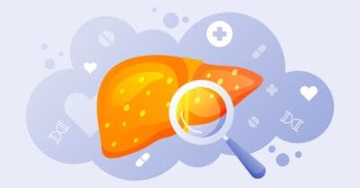 Liver Elastography - Detect Liver Disease Early